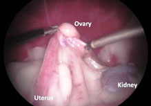 keyhole ovary